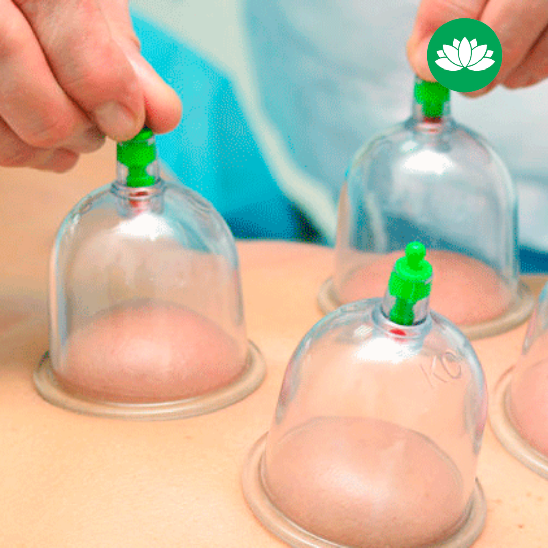 Terapia cu Ventuze Alba Iulia